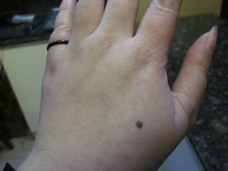 長在手上的痣有何寓意 長在手上的痣有何寓意