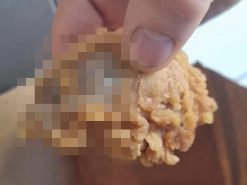 外賣炸雞驚現炸雞頭? 外賣炸雞驚現炸雞頭?