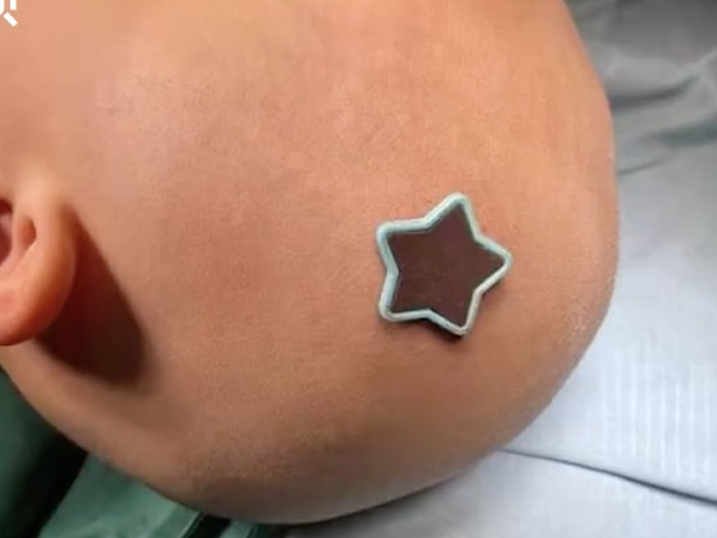 3歲女童跌床落 剛好地上有顆長釘，結果 ...