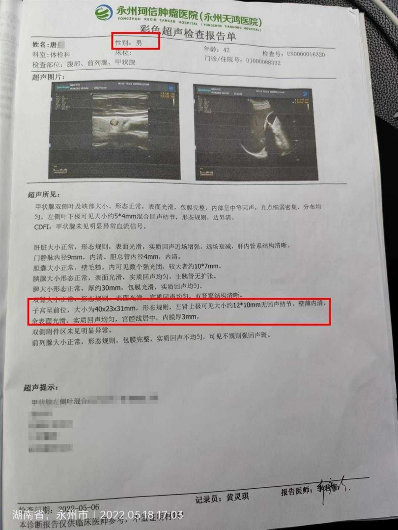 42歲人夫體檢 發現有子宮
