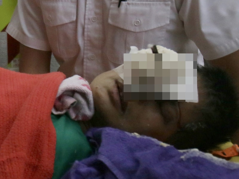 恐怖工業意外 貨倉女工鐵枝插眼