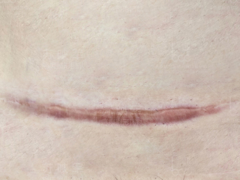 你身上有前世的胎疤嗎? 你身上有前世的胎疤嗎?