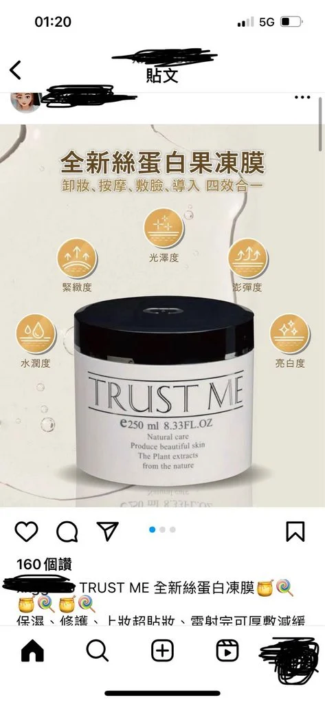 KTV 遭潑熱湯恐毀容 傷者更新自拍照 最新傷勢曝光