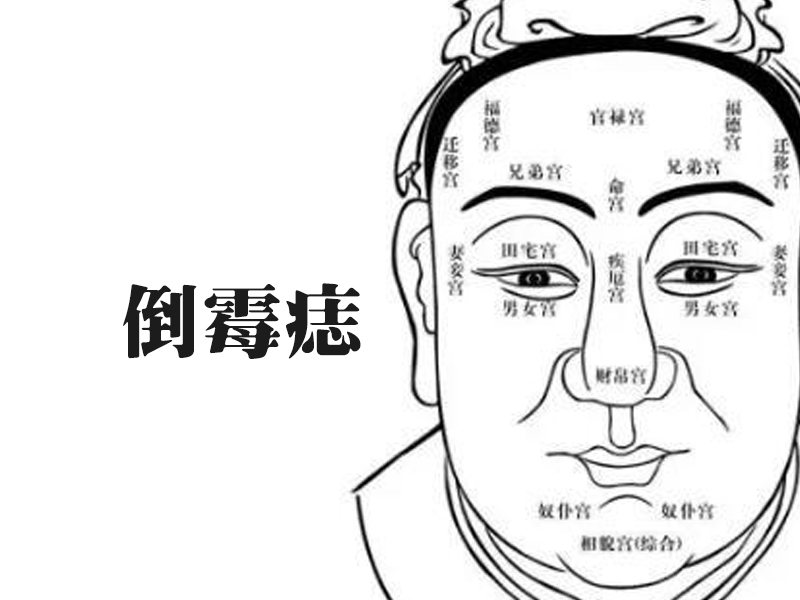 四種倒霉痣,破財漏財感情不順,晚年孤獨無依 四種倒霉痣,破財漏財感情不順,晚年孤獨無依