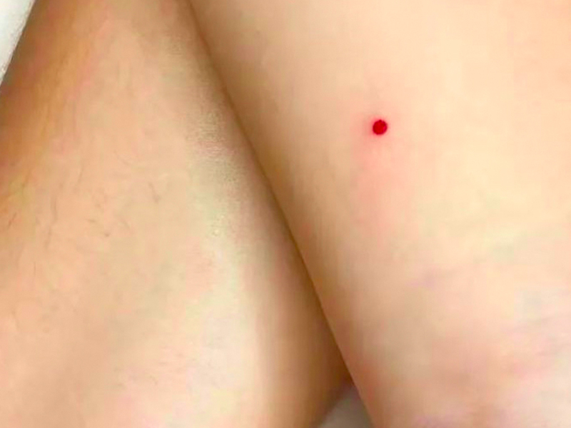 男人生殖部位長痣,說明此人對待感情不是很專一 男人生殖部位長痣,說明此人對待感情不是很專一