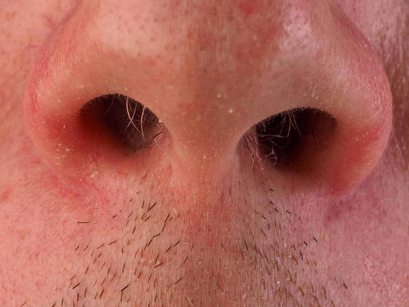 鼻毛變白,代表什麼?男性要重視 鼻毛變白,代表什麼?男性要重視