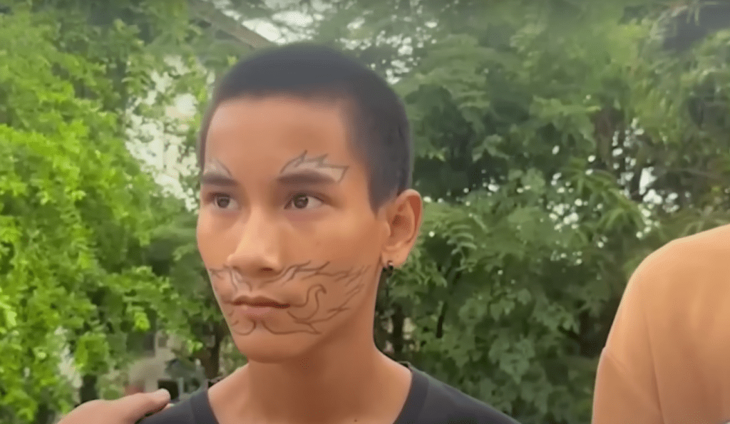 朋友慫恿之下，少年在面上紋身，結果後悔了
