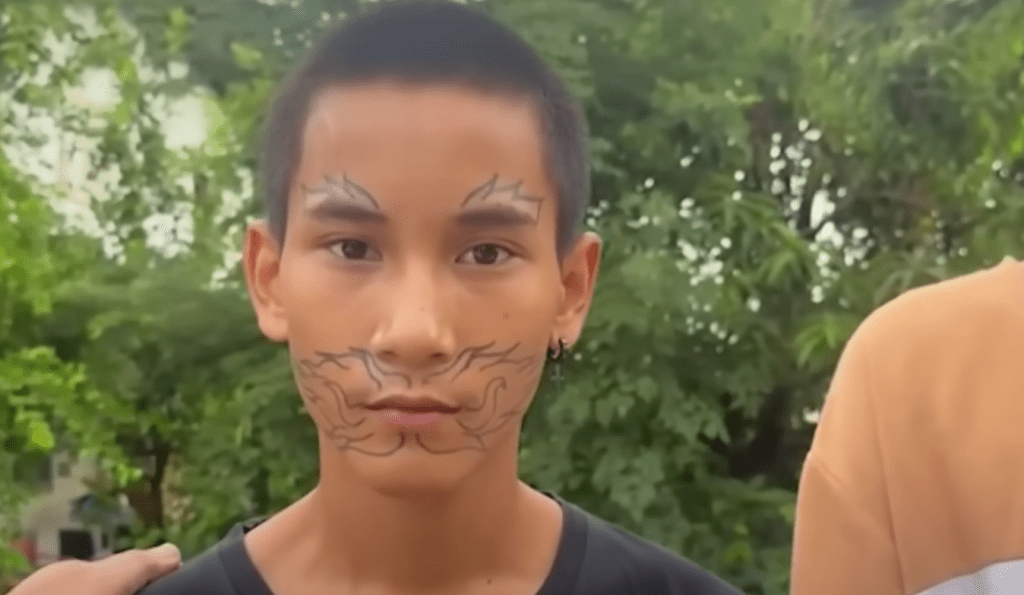 朋友慫恿之下，少年在面上紋身，結果後悔了