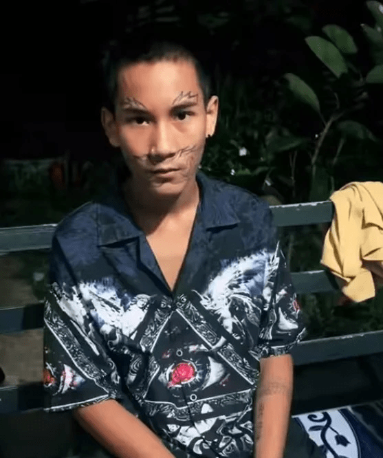 朋友慫恿之下，少年在面上紋身，結果後悔了
