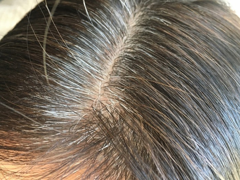 防白髮吃什麼？中醫推薦 5 大烏髮聖品