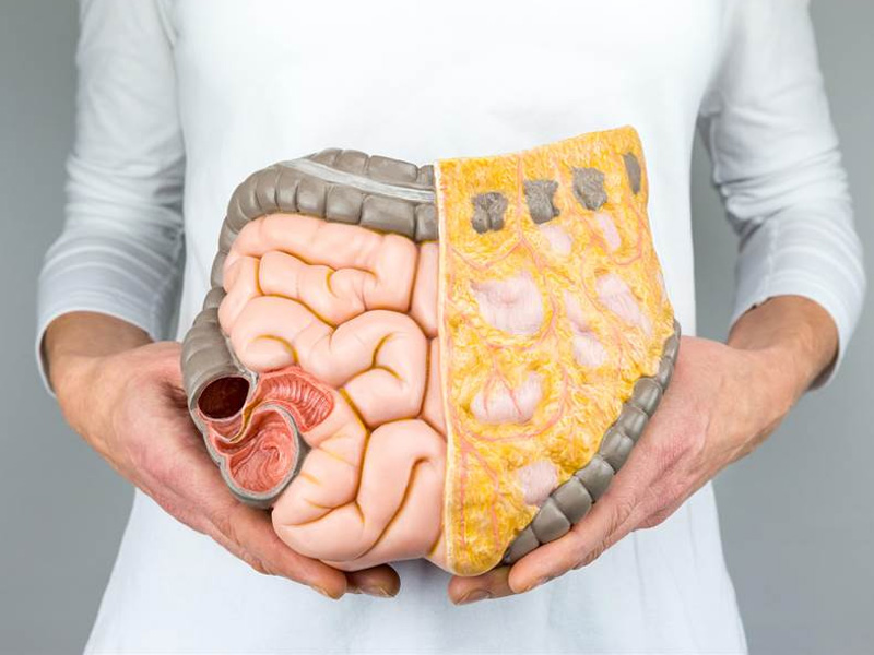 內臟脂肪至少含30種毒!肥肉就是長得比較慢的「癌症」 內臟脂肪至少含30種毒!肥肉就是長得比較慢的「癌症」