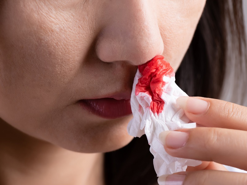 男子鼻出血不止，原是這些習慣惹的禍