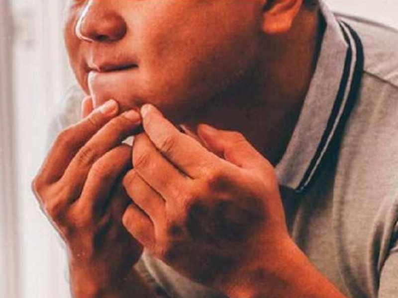 擠暗瘡擠到肺組織壞死