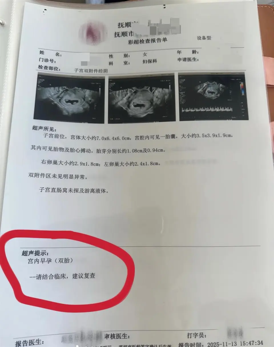 孕婦一胎變四胞胎，每次產檢多一胎