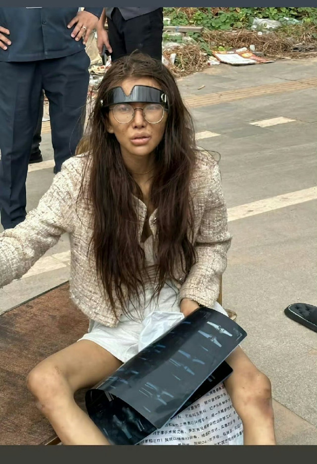 女網紅被男友賣柬埔寨 如今雙腿骨折流浪街頭